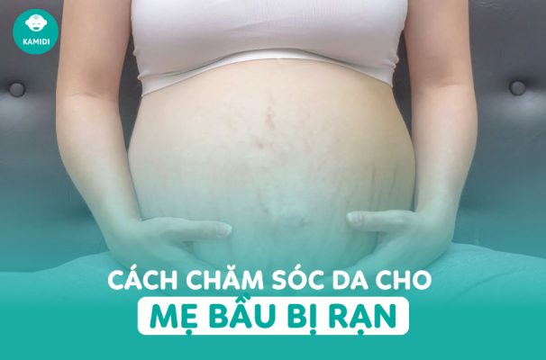 mẹ bầu bị rạn