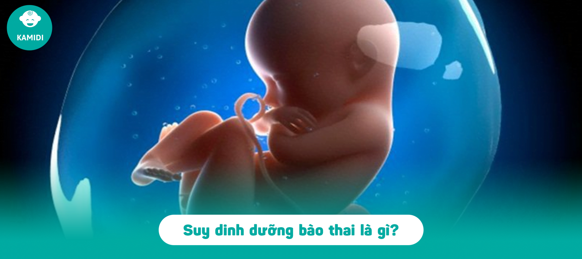 Suy dinh dưỡng bào thai nguy hiểm thế nào, nguyên nhân là gì? 2 suy-dinh-duong-bao-thai-1