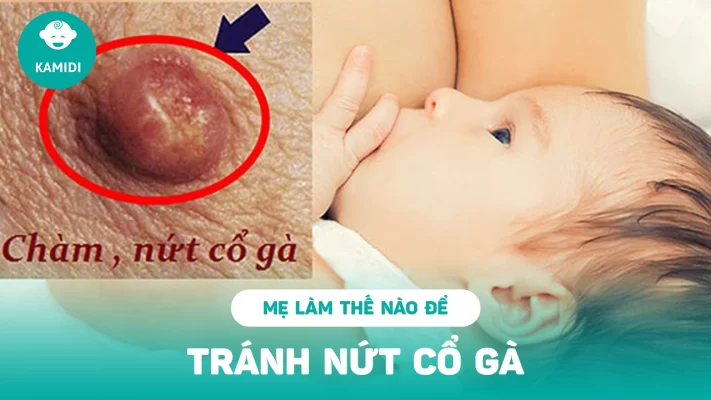 lam-the-nao-de-tranh-nut-co-ga