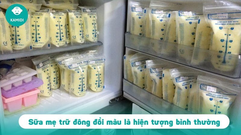 Sữa mẹ sau sinh và 7 câu hỏi thường gặp 3 sua-me-sau-sinh-2
