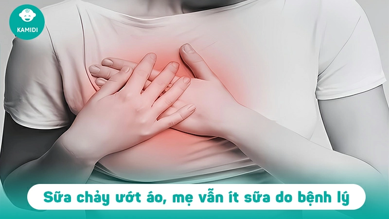 Sữa chảy ướt áo nhưng vẫn ít sữa, nguyên nhân vì sao? 3 sua-chay-uot-ao-nhung-van-it-sua-2