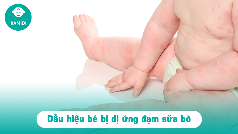 tre-bi-di-ung-dam-sua-bo-2