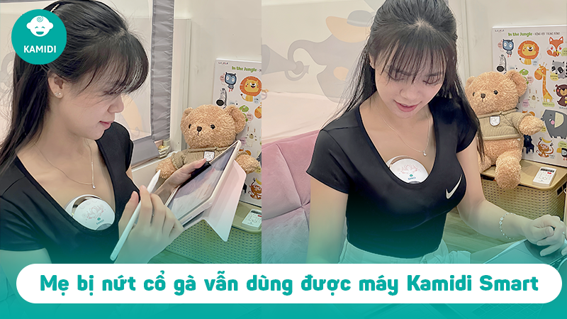 Mẹ bị nứt cổ gà có nên sử dụng máy hút sữa không dây Kamidi Smart không? 3 su-dung-may-hut-sua-khong-day-kamidi-smart-1