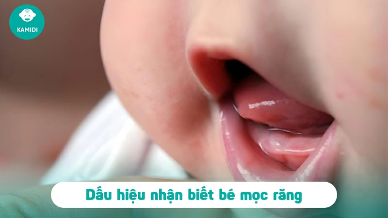 Bí quyết giúp bé giảm đau khi mọc răng tại nhà 2 bi-quyet-giup-be-giam-dau-khi-moc-rang-1
