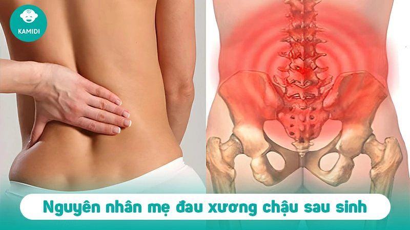 Nguyên nhân đau xương chậu sau sinh và cách khắc phục 2 dau-xuong-chau-sau-sinh-1