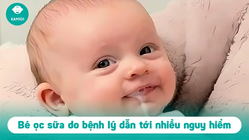 Trẻ sơ sinh bị ọc sữa phải làm sao? Cách xử lý hiệu quả 2 tre-so-sinh-bi-oc-sua-1