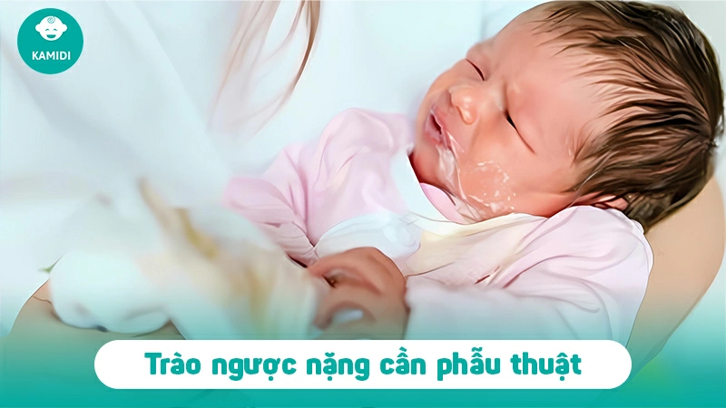 trao-nguoc-da-day-thuc-quan-o-tre-so-sinh-3