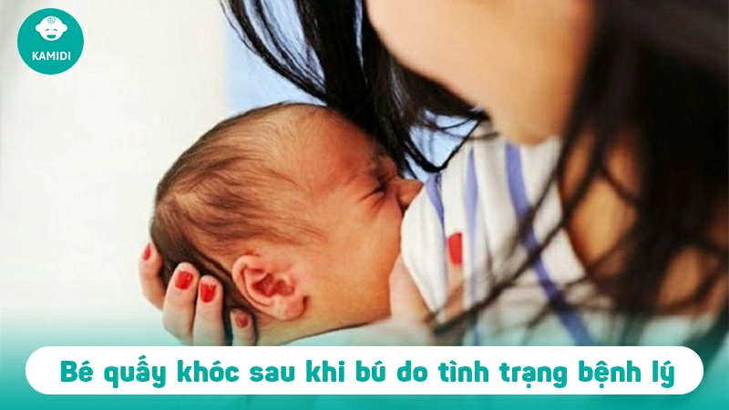 Trẻ quấy khóc sau khi bú nguyên nhân vì sao? 2 tre-quay-khoc-sau-khi-bu-1