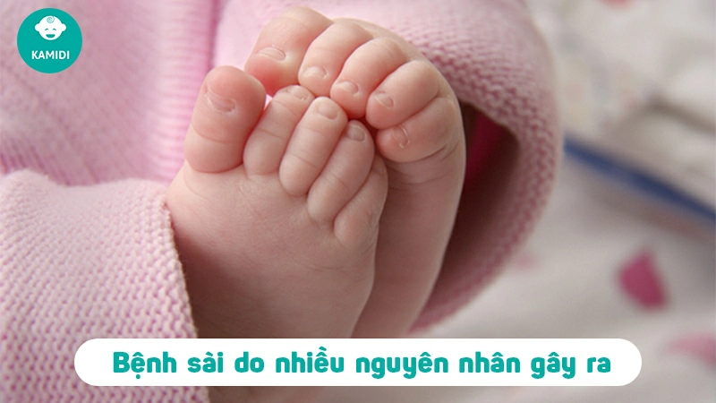 nguyen-nhan-tre-so-sinh-bi-sai-1