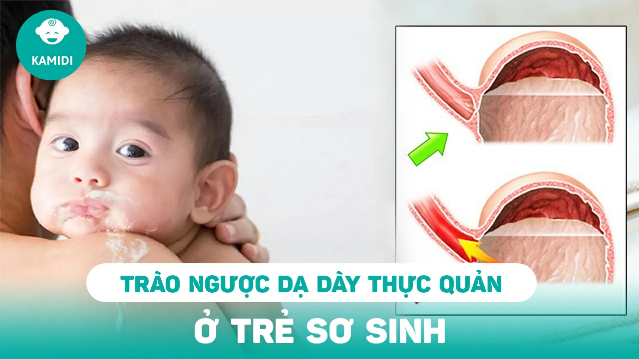 trao-nguoc-da-day-thuc-quan-o-tre-so-sinh