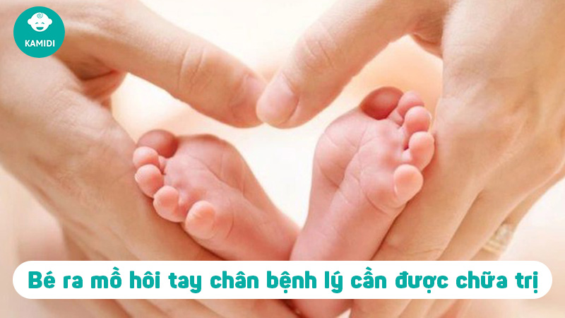 Trẻ sơ sinh ra mồ hôi tay chân có đáng lo không? 3 tre-so-sinh-ra-mo-hoi-tay-chan-2