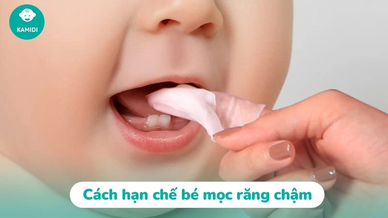 Trẻ mọc răng chậm nguyên nhân do đâu? Cách khắc phục 4 tre-moc-rang-cham-3