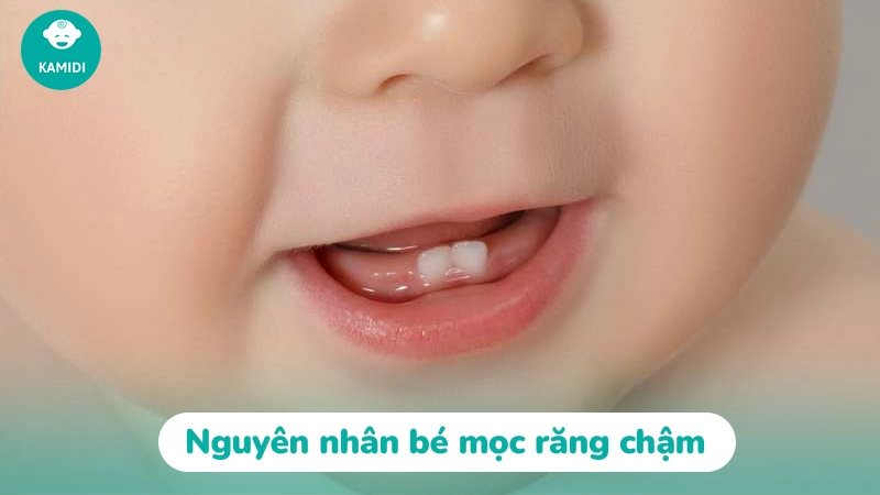 Trẻ mọc răng chậm nguyên nhân do đâu? Cách khắc phục 3 tre-moc-rang-cham-2