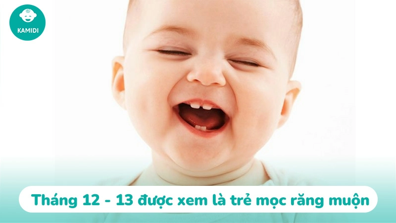 Trẻ mọc răng chậm nguyên nhân do đâu? Cách khắc phục 2 tre-moc-rang-cham-1