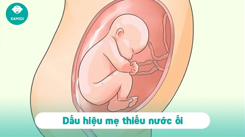 Uống gì để tăng nước ối nhanh cho mẹ bầu 2 uong-gi-de-tang-nuoc-oi-nnhanh-1