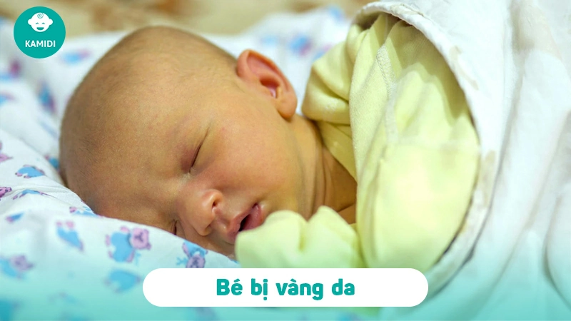 Các bệnh ngoài da ở trẻ sơ sinh mẹ cần lưu ý 2 cac-benh-ngoai-da-o-tre-so-sinh-1