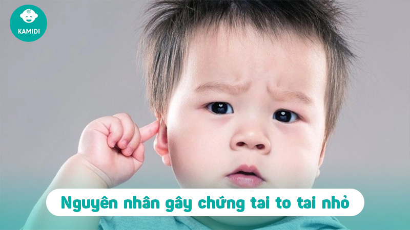 Tai to tai nhỏ ở trẻ sơ sinh: Những điều mẹ cần biết 2 tai-to-tai-nho-o-tre-1