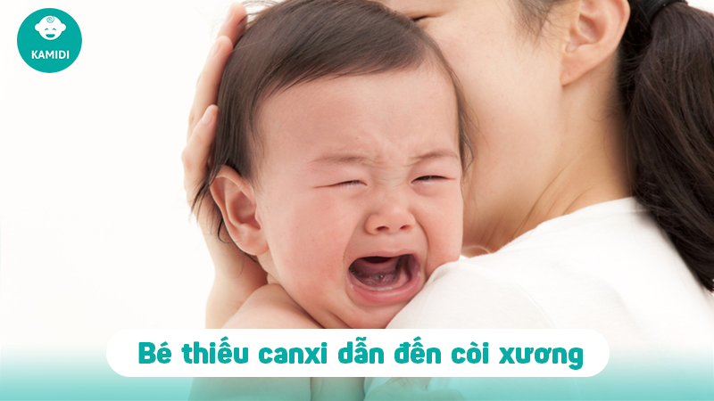 Dấu hiệu trẻ bị thiếu Canxi và cách chữa trị cho bé 3 dau-hieu-tre-bi-thieu--2