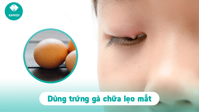 Bật mí mẹo chữa lẹo mắt ở trẻ em đơn giản và hiệu quả tại nhà 4 meo-chua-leo-mat-o-tre-em-3