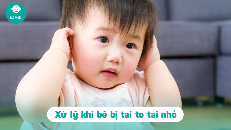 Tai to tai nhỏ ở trẻ sơ sinh: Những điều mẹ cần biết 4 tai-to-tai-nho-o-tre-3
