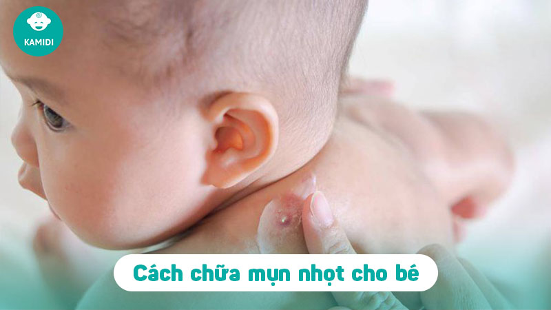 cach-chua-mun-nhot-o-tre-em-2