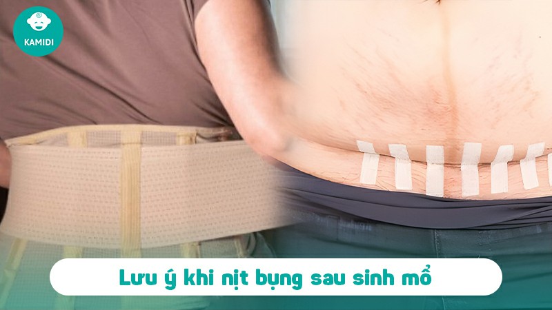 Sau sinh mổ bao lâu thì nịt bụng được? Hướng dẫn mẹ sinh mổ nịt bụng đúng cách 4 sau-sinh-mo-bao-lau-thi-nit-bung-duoc-3