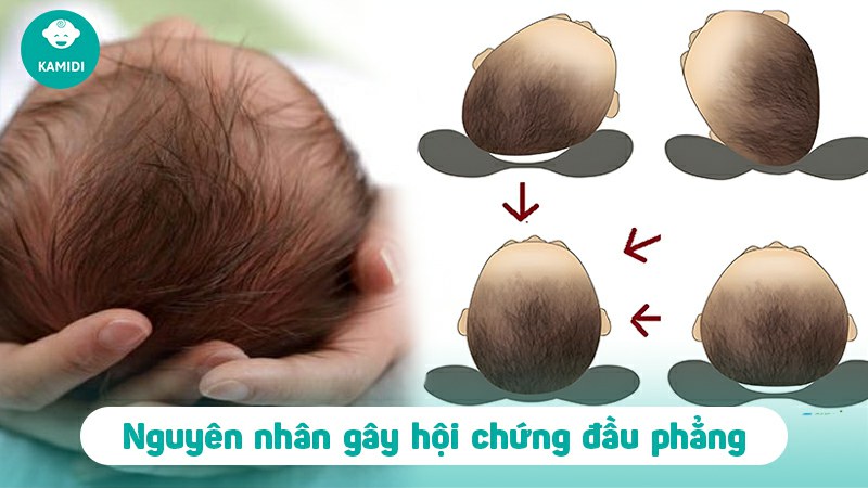 hoi-chung-dau-phang-o-tre-em-2