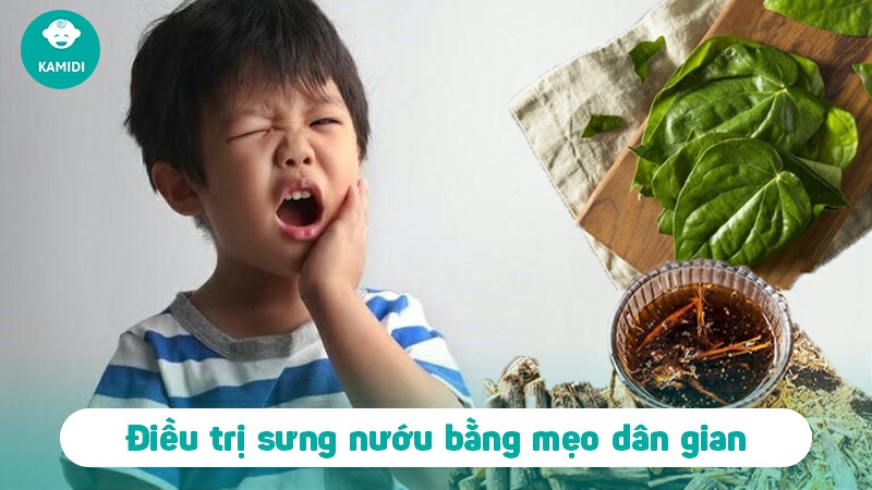 Trẻ bị sưng nướu: Nguyên nhân và cách điều trị 4 tre-bi-sung-nuou-3