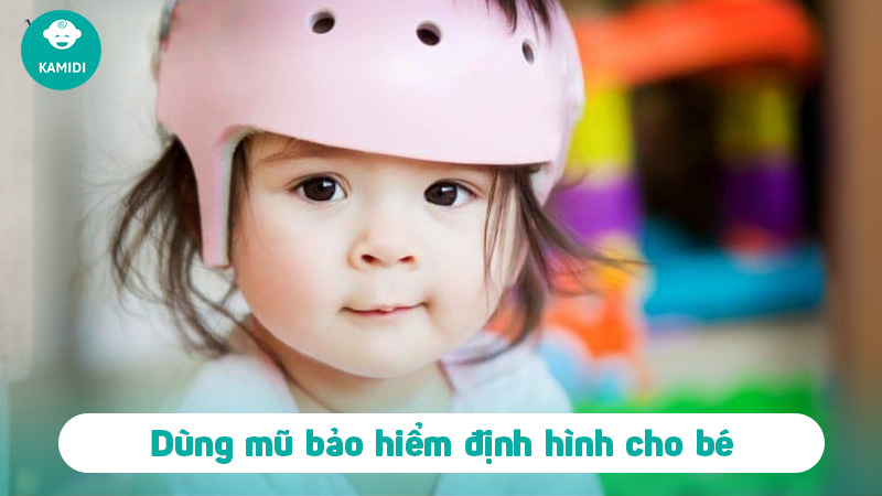 Mẹo dân gian chữa méo đầu ở trẻ sơ sinh hiệu quả mẹ nên biết 5 meo-dan-gian-chua-meo-dau-o-tre-so-sinh-4