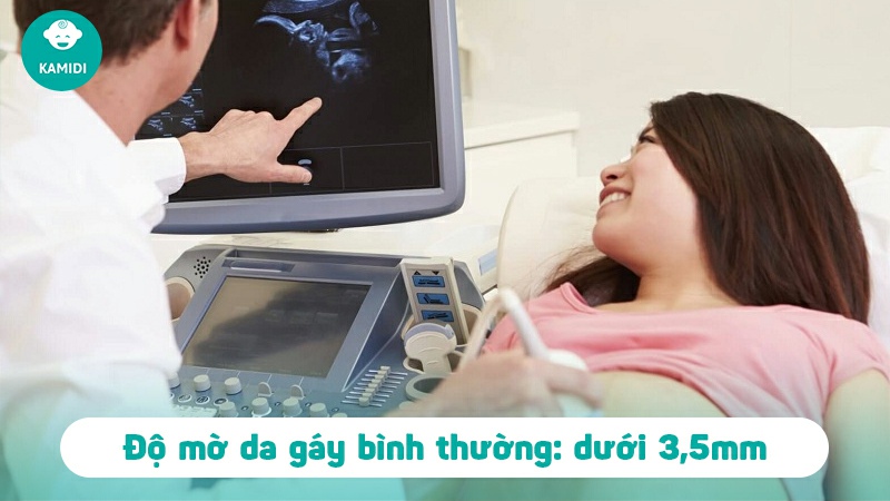 Độ mờ da gáy thai nhi - Vấn đề mẹ khồng thể bỏ qua 3 do-mo-da-gay-thai-nhi-2