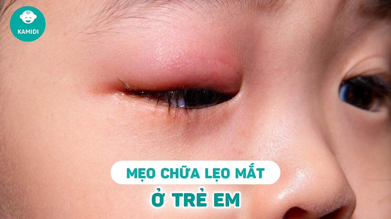 meo-chua-leo-mat-o-tre-em