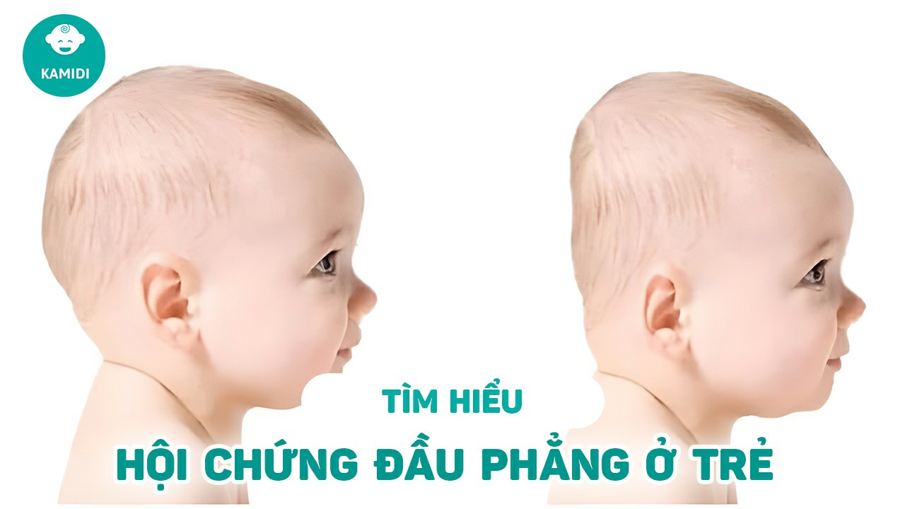 hoi-chung-dau-phang-o-tre-em