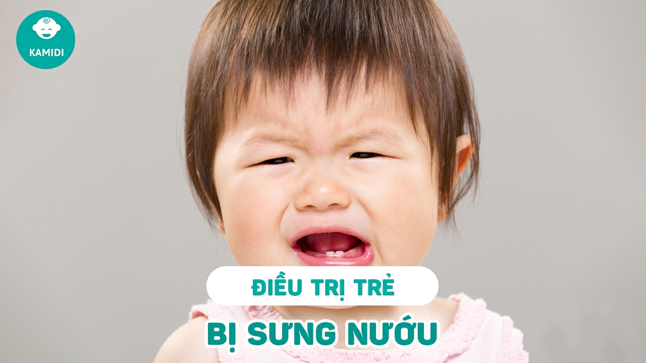 tre-bi-sung-nuou