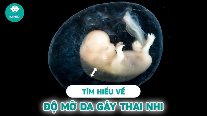 do-mo-da-gay-thai-nhi