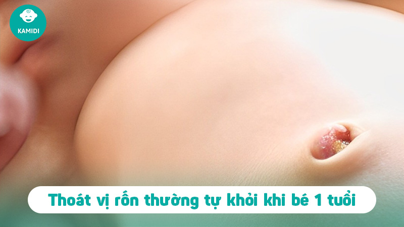 Thoát vị rốn ở trẻ sơ sinh: Nguyên nhân và cách điều trị 4 thoat-vi-ron-o-tre-so-sinh-3