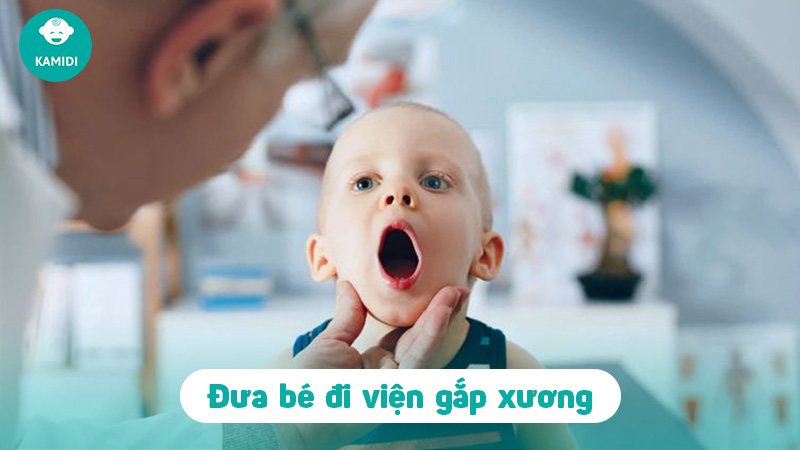 Mách ba mẹ cách xử trí khi trẻ bị hóc xương cá hiệu quả 5 tre-bi-hoc-xuong-ca-4