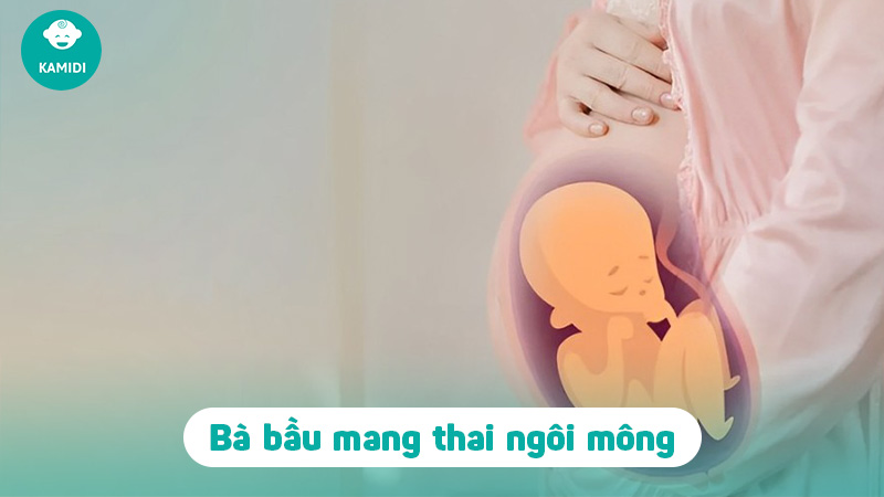 Thai ngôi mông là gì? Làm thế nào khi thai nhi ngôi mông 2 thai-ngoi-mong-la-gi-1
