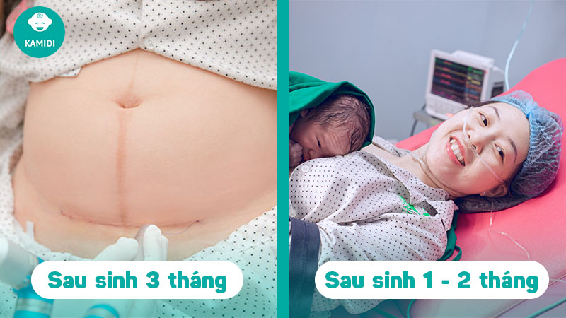 Sau sinh ăn mực được không? Ăn mực cần lưu ý điều gì? 5 sau-sinh-an-muc-duoc-khong-4