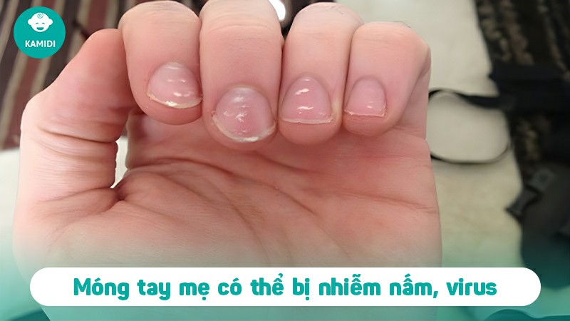 bau-son-mong-tay-duoc-khong-3