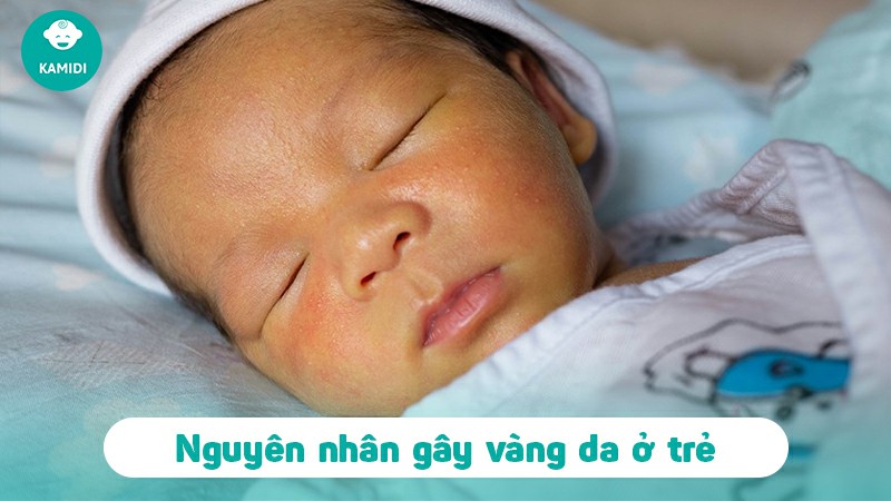 meo-dan-gian-chua-vang-da-o-tre-so-sinh-1