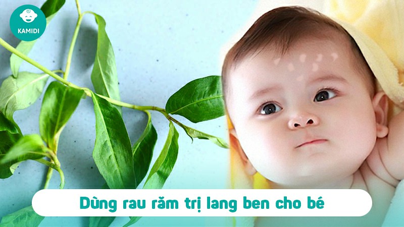 Lang ben ở trẻ sơ sinh có nguy hiểm không: Nguyên nhân và cách điều trị 5 lang-ben-o-tre-so-sinh-co-nguy-hiem-khong-4