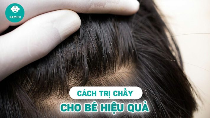cach-tri-chay-cho-be