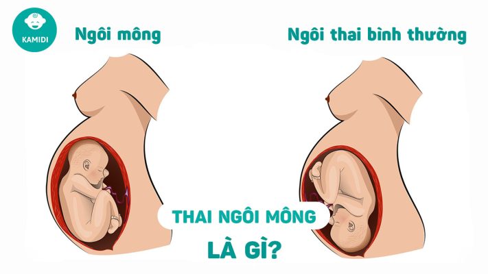 thai-ngoi-mong-la-gi