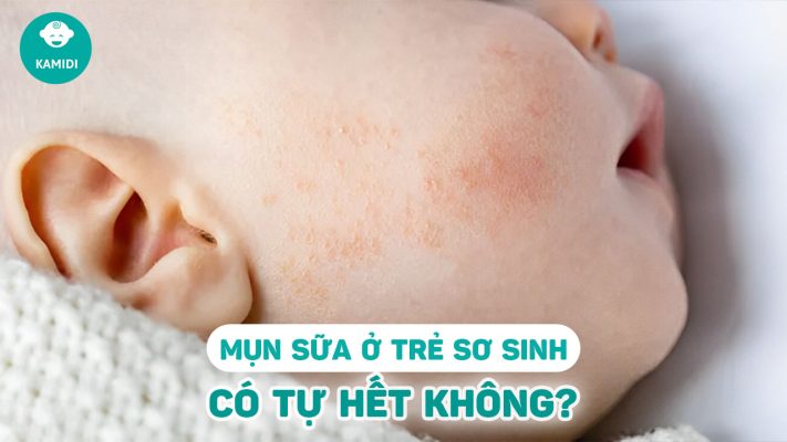 mun-sua-o-tre-so-sinh