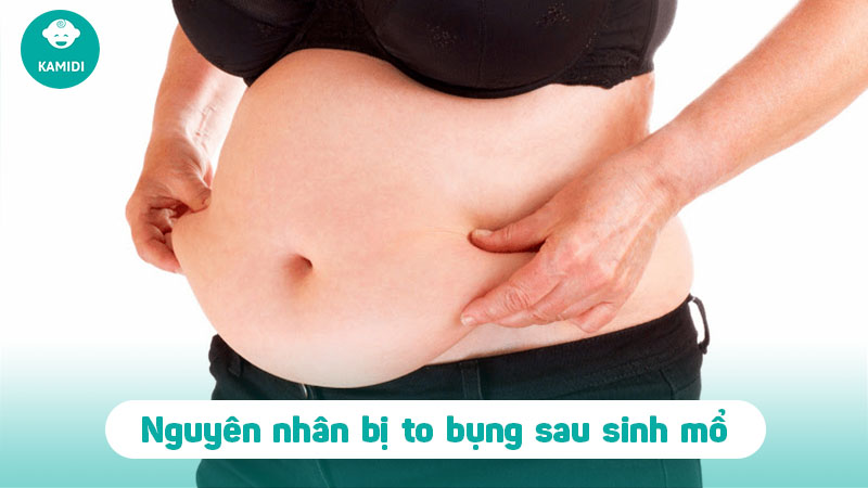 cach-lam-xep-bung-sau-sinh-mo-1