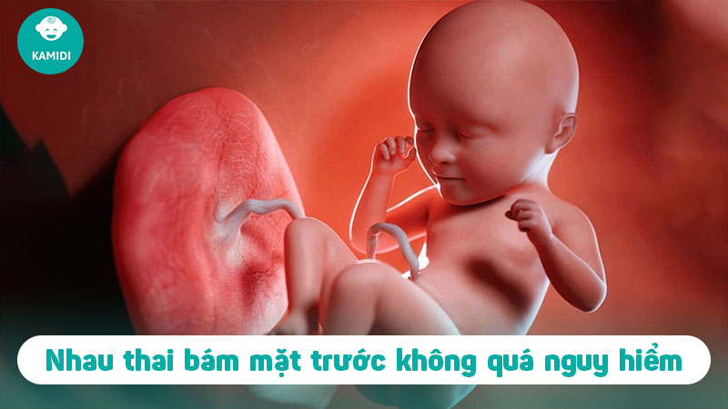 Nhau thai bám mặt trước là gì? Mẹ bầu nên lưu ý những gì? 2 nhau-thai-bam-mat-truoc-1