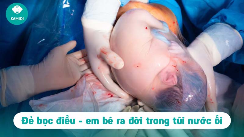 Đẻ bọc điều là gì? Có thật sự đem lại may mắn không? 2 de-boc-dieu-la-gi-1