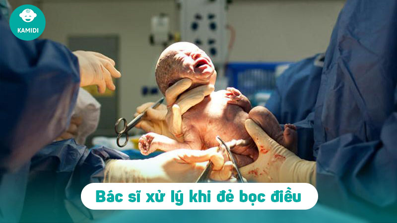 Đẻ bọc điều là gì? Có thật sự đem lại may mắn không? 4 de-boc-dieu-la-gi-3