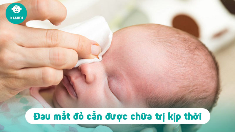 meo-chua-dau-mat-do-cho-tre-so-sinh-2