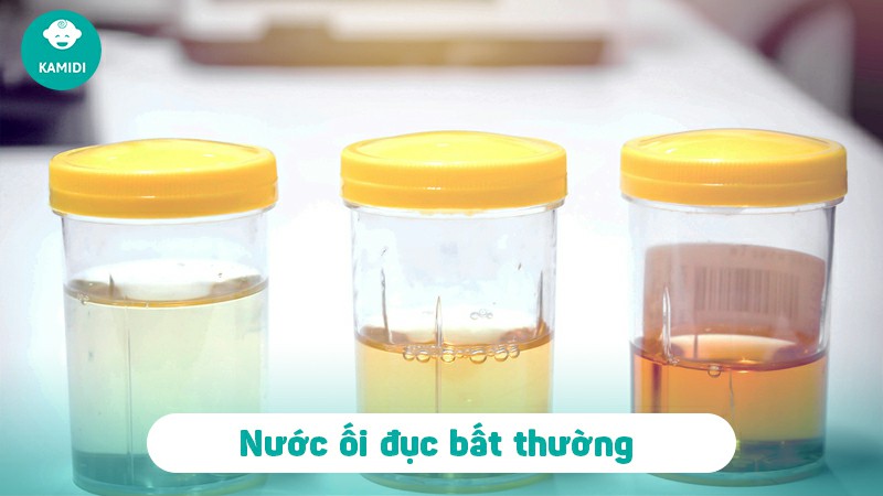Nước ối đục có nguy hiểm không? Nước ối đục nên uống gì? 3 nuoc-oi-duc-co-nguy-hiem-khong-2